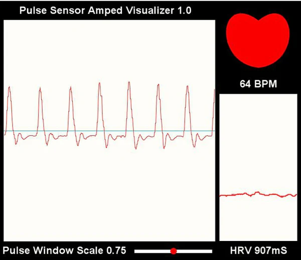 Heart Rate (Pulse) Sensor - Image 3